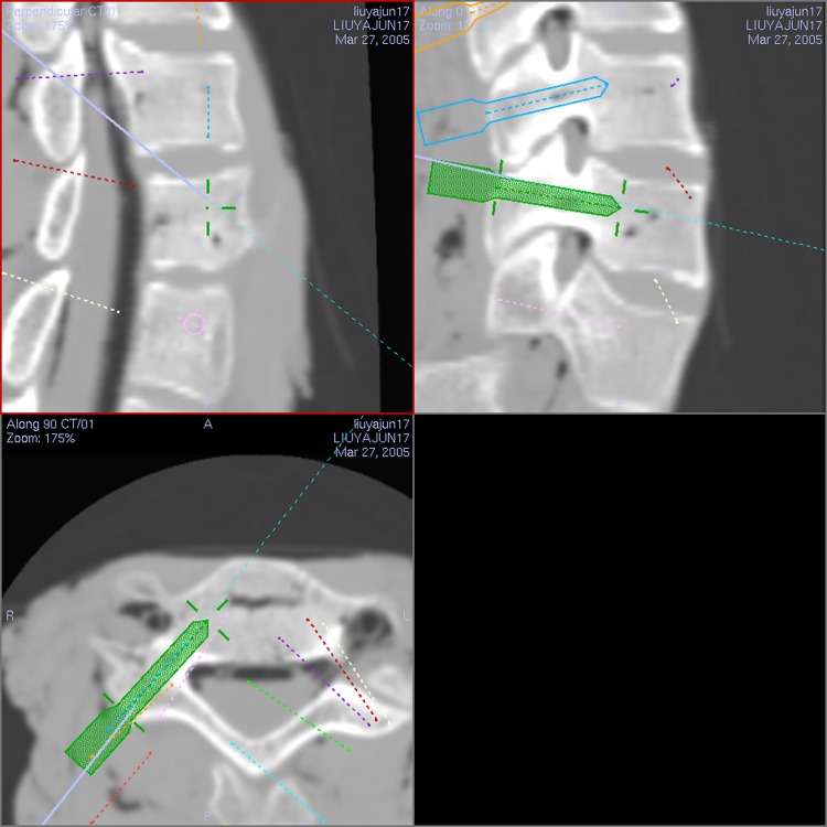 Fig. 3