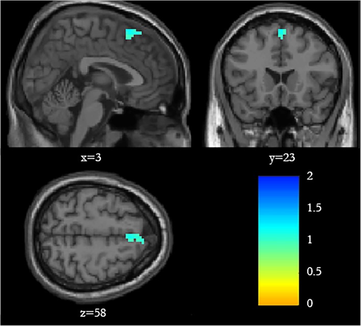 Figure 2