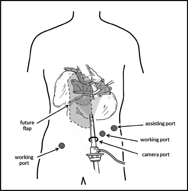 Fig. 2