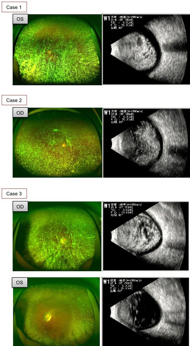 Figure 1