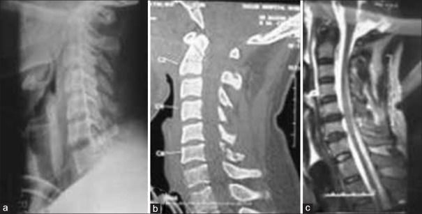 Figure 23