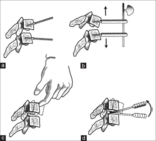 Figure 16