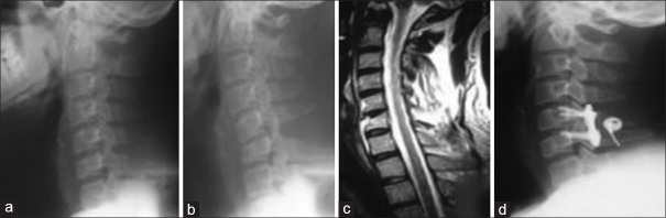 Figure 15