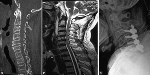 Figure 21