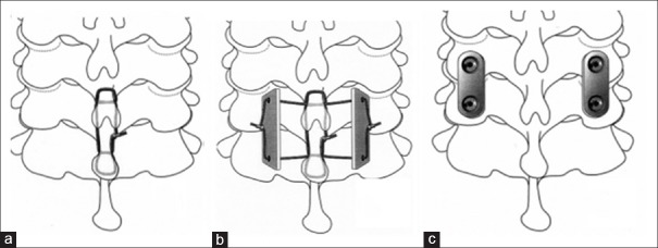 Figure 17