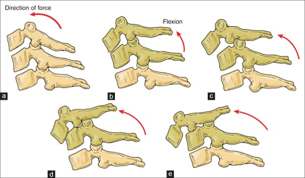 Figure 14