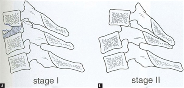 Figure 22