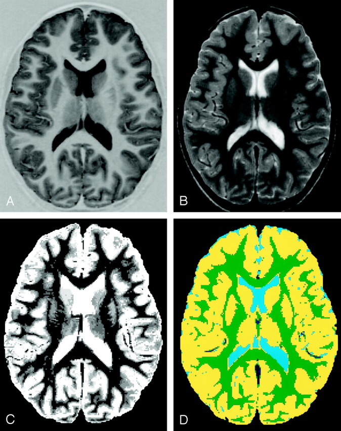 Fig 1.