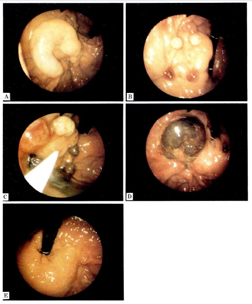 Fig. 3.