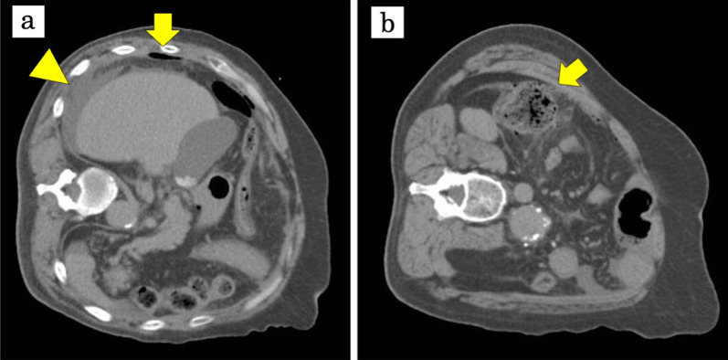 Fig. 1