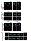 Fig.1. Immunofluorescence microscopic studies using anti-sPLA<sub>2</sub>-V antibody or anti-Myc-tag antibody for nuclear localization of sPLA<sub>2</sub>-V