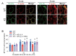 Fig.6. Impairment of actin polymerization in sPLA<sub>2</sub>-V KD RAW264.7 cells