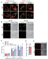 Fig.5. Maturation of endosomes containing AcLDL and fusion of endosomes and lysosomes in RAW264.7 cells