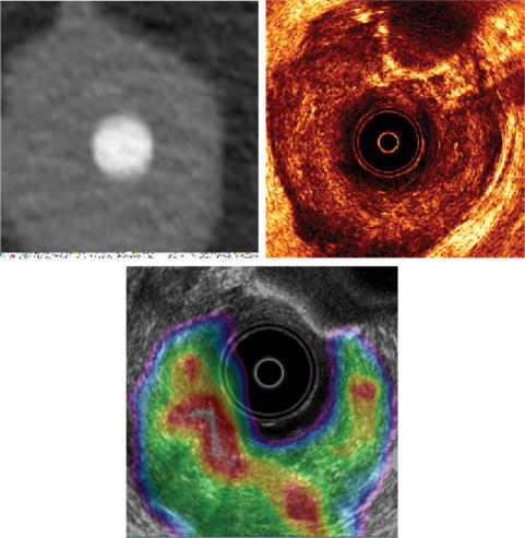 Figure 11