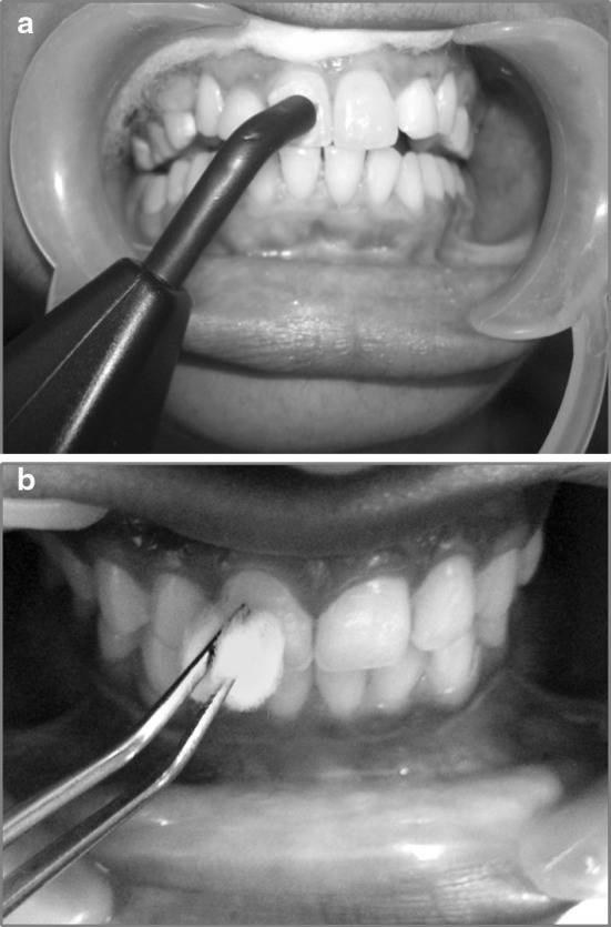 Fig. 3