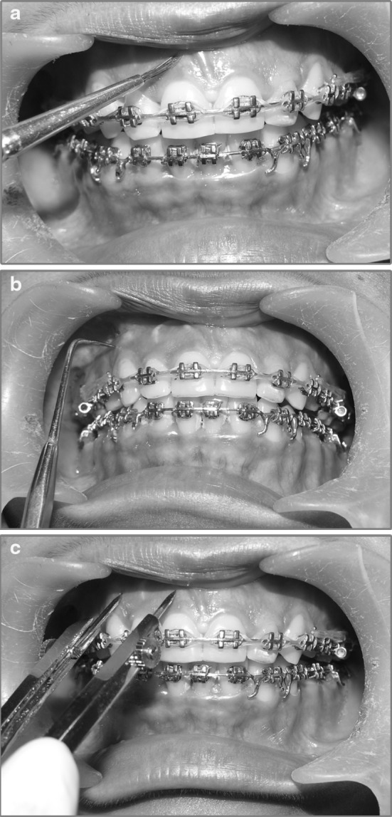 Fig. 2