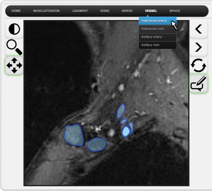 Figure 3a