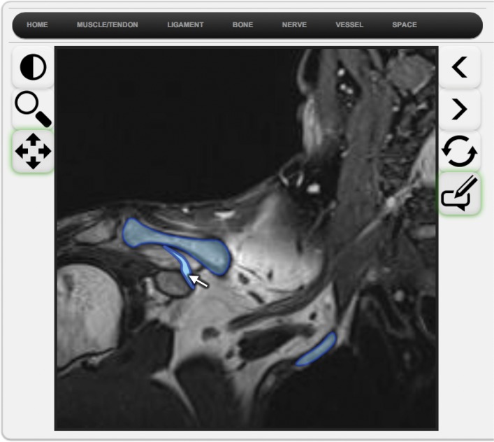 Figure 3b