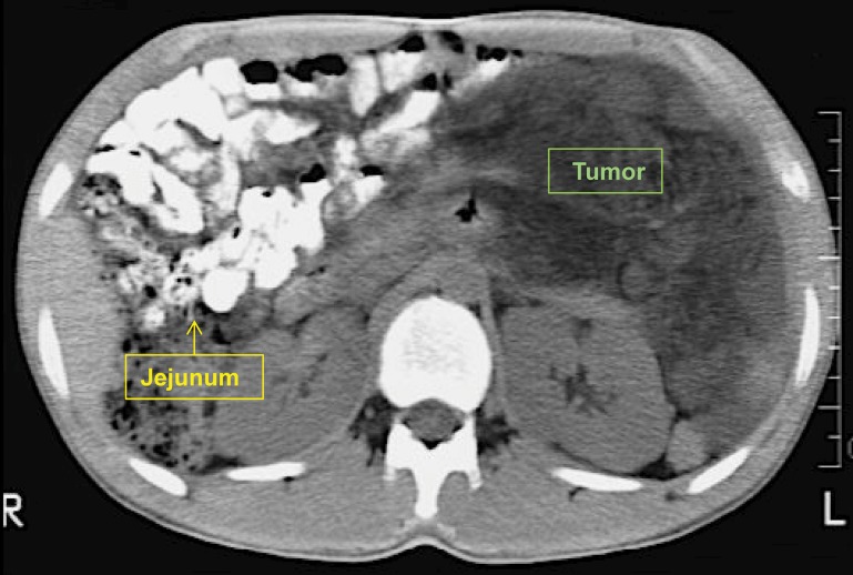 Fig. 2