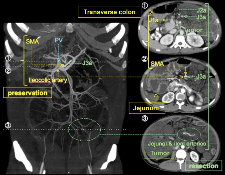 Fig. 3