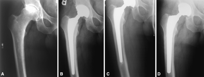 Fig. 1A–D