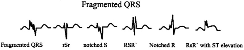 Fig. (1)