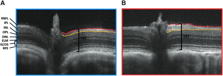 FIG. 5.