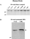 Fig. 12.