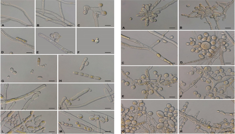 Micrographs feature changes in M. germinans with no sugar, as it starts as long filaments, breaks up, and turns into yeast-like cells; More sugar promoting yeast form and similar changes at 37 degrees Celsius, but with more without sugar.