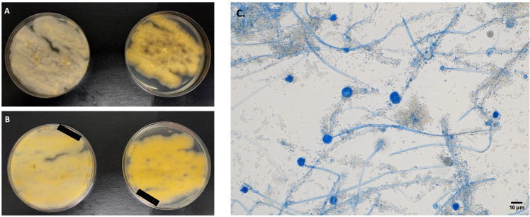 Photos feature the top and bottom surfaces of colonies grown on a specific medium at two temperatures. The micrograph features fungal structures with stalks with round spore sacs at their tips and central structures within the spore sacs.