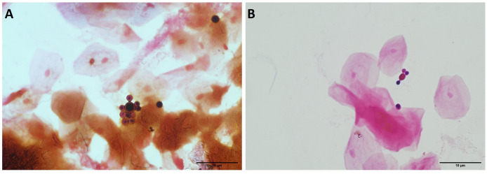 Micrographs of a cell with multiple round buds on its surface and of a cell with a single larger bud, resembling Mickey Mouse's head.