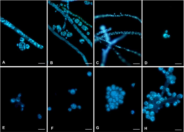 Micrographs feature the nuclei in Mucor germinans at 25 degrees Celsius and 37 degrees Celsius. At both temperatures, the fungus has multiple nuclei in its cells, yeast-like spores, and filaments, as indicated by the glowing stains.