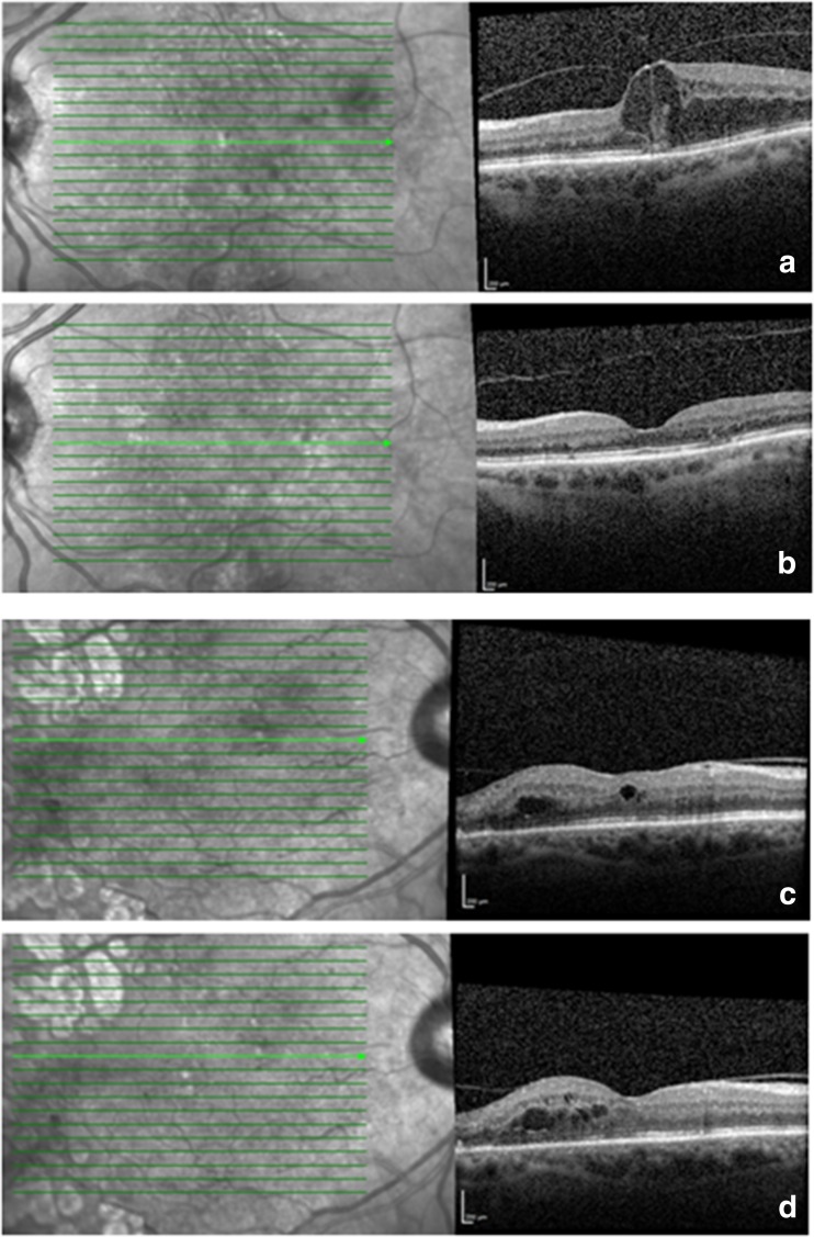 Fig. 1
