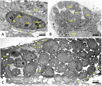 Figure 11