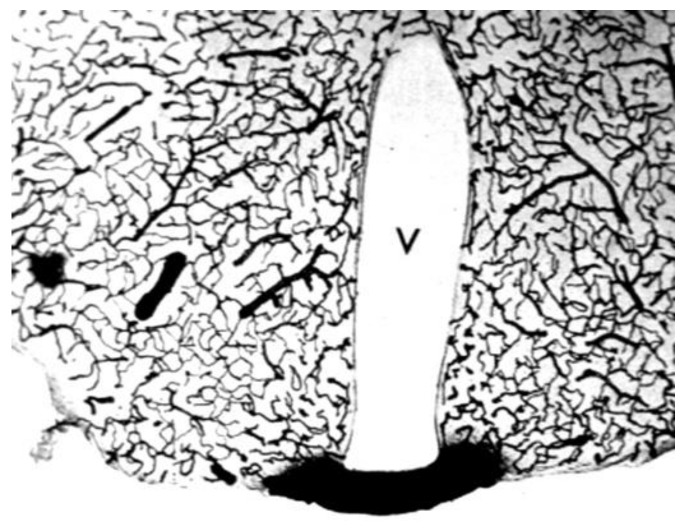 Figure 21