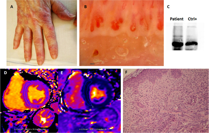 Figure 1