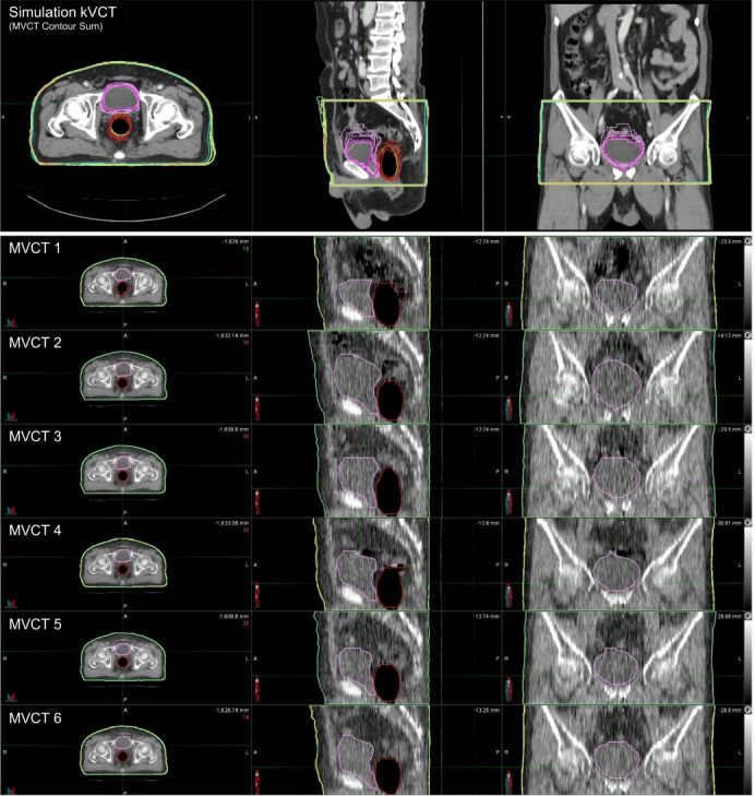 Fig. 7.