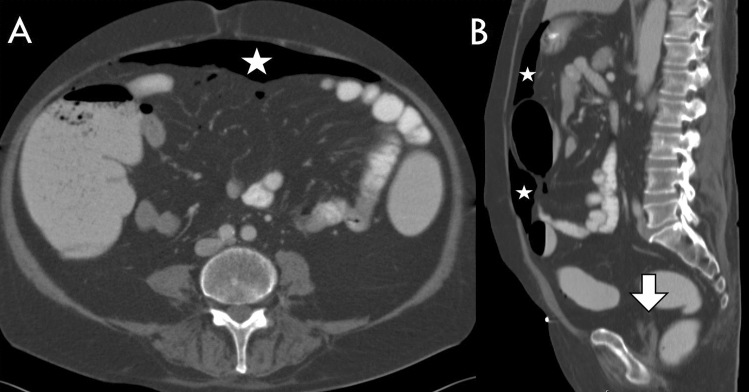 Fig. 7