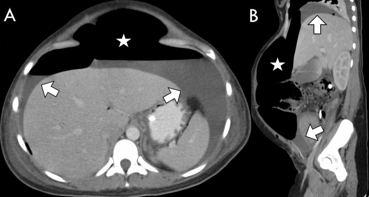 Fig. 6