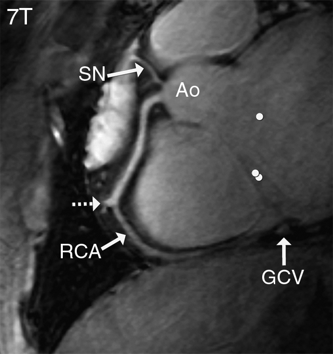 Figure 4a: