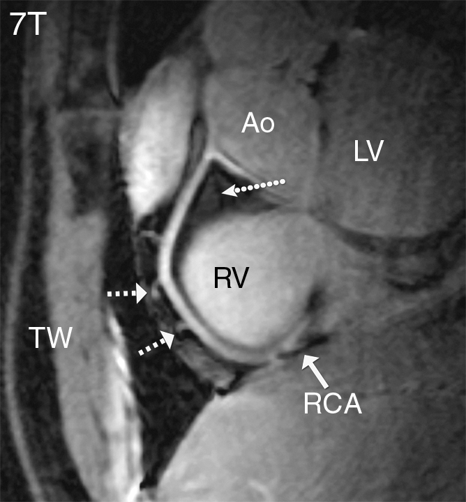 Figure 2a: