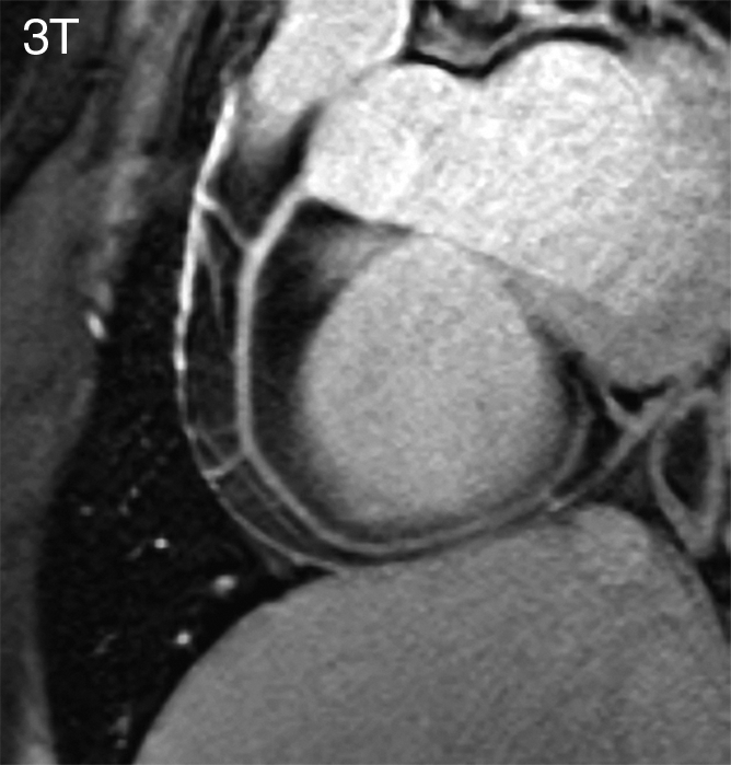 Figure 3b: