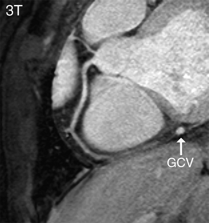 Figure 4b: