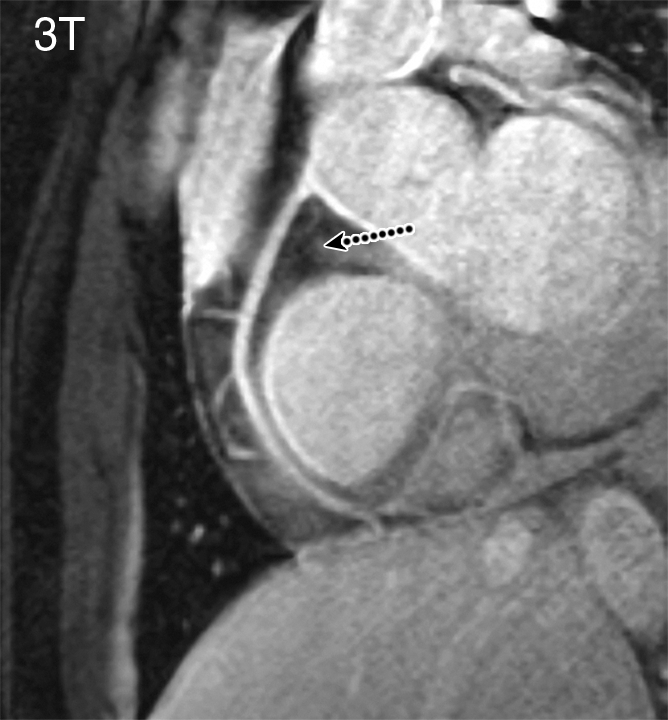 Figure 2b: