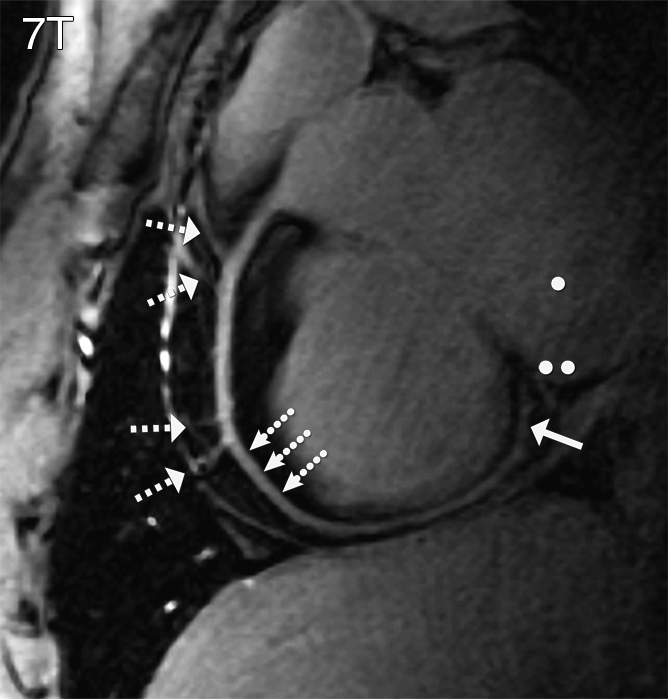 Figure 3a: