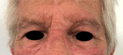 Fig. 8