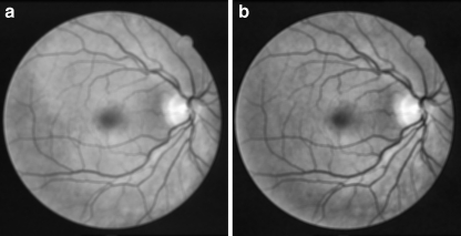 Fig. 5