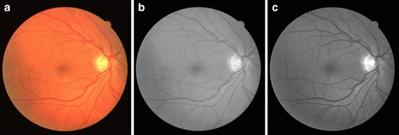 Fig. 2