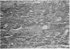 113