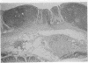 114